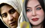 سمی ترین عکس های این 7 بازیگر / چرا این شکلی بودند ؟!